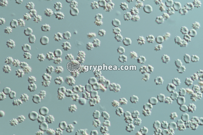 Hématies en milieu hypertonique x160 - gryphea.org